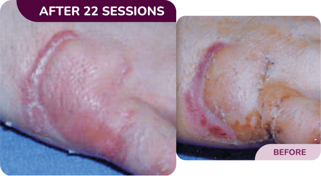 rejuvenate laser and skin clinic - scarring treatment